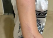 Wanita di Palopo Dianiaya di Dalam Rumahnya, Keluarga Minta Pelaku Segera Ditangkap