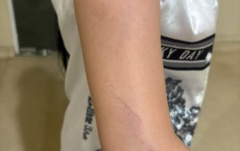 Wanita di Palopo Dianiaya di Dalam Rumahnya, Keluarga Minta Pelaku Segera Ditangkap